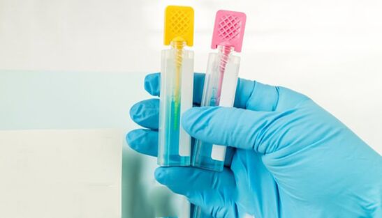Metody diagnostyki pasożytów